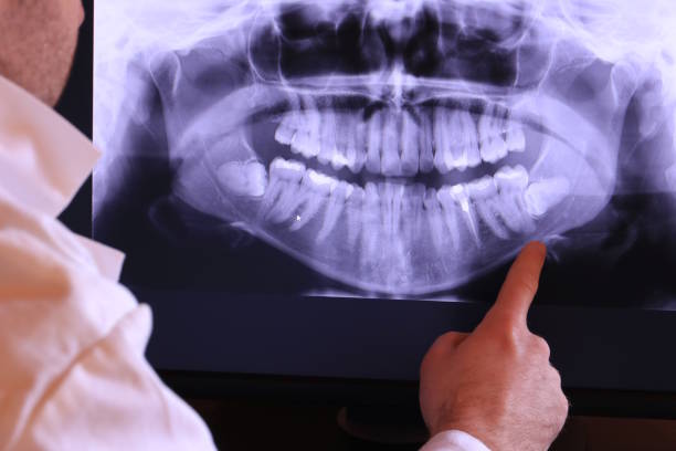 Best Emergency Dental Services for Seniors in Bull Valley, IL