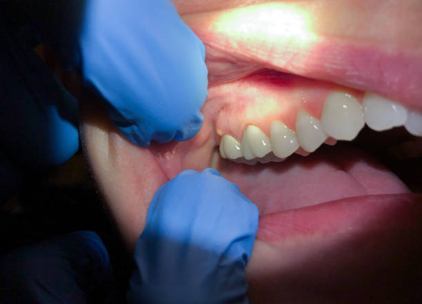 Best Broken or Cracked Tooth Emergency Dentist in Bull Valley, IL