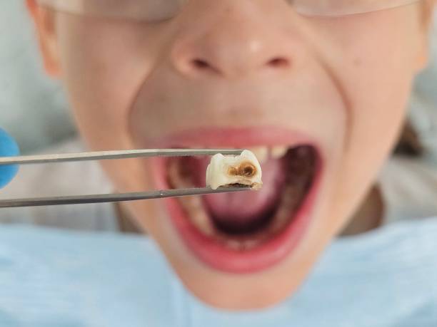 Best Urgent Dental Care for Toothache in Bull Valley, IL